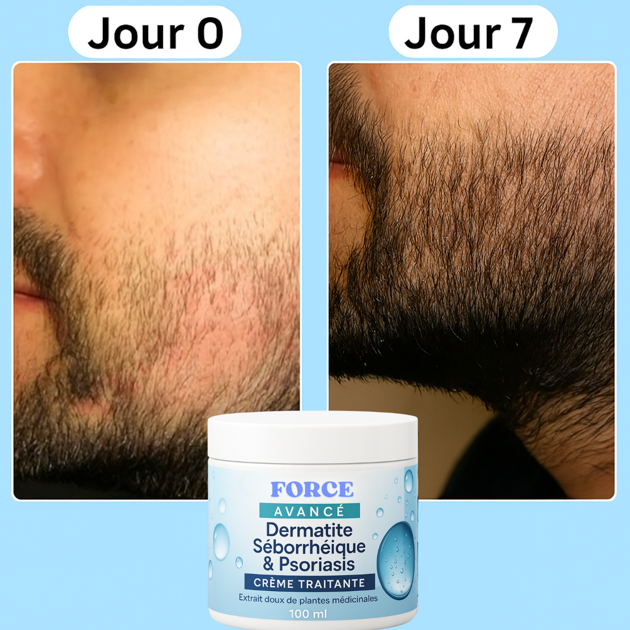 ForceSkin™ – Crème Apaisante Barbe & Visage
