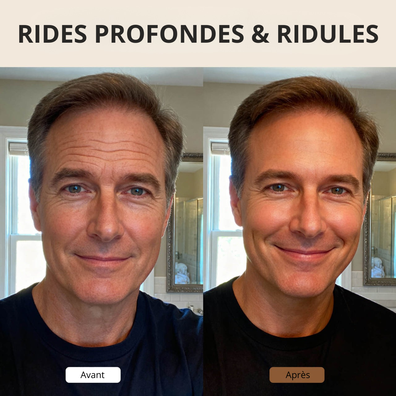 ForceSkin -  Crème Anti-Rides V2